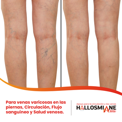 Hallosmine Acua, Suplemento Líquido para las circulación en piernas y apoyo venoso, con Vinagre de Manzana, Magnesio, Vitamina C y Omega 3 | 500 ml